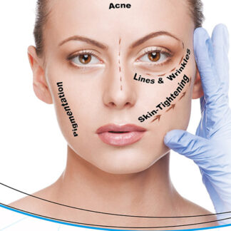 Non Surgical Facelift